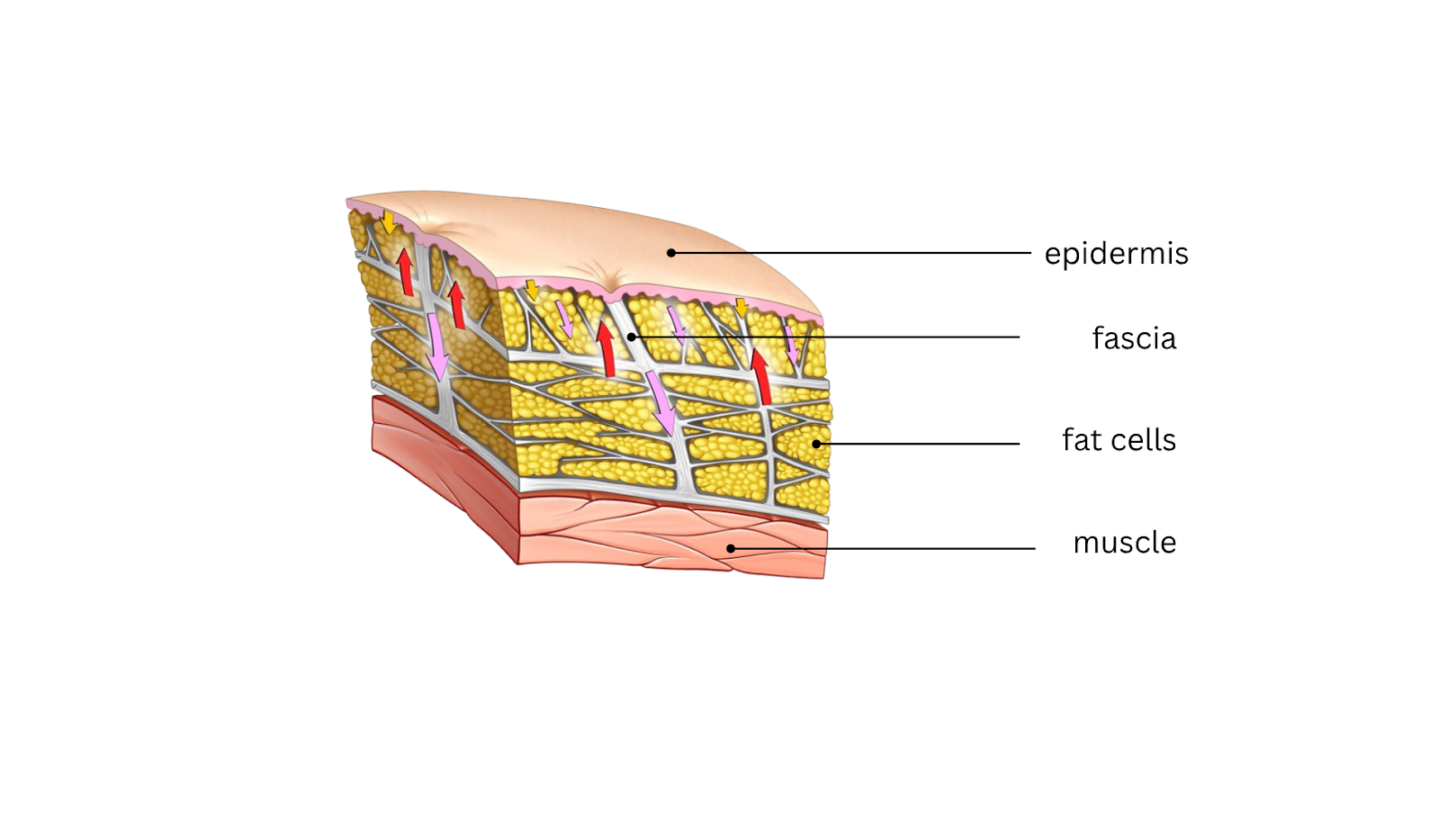 Cellulite vs. Lipedema: When 